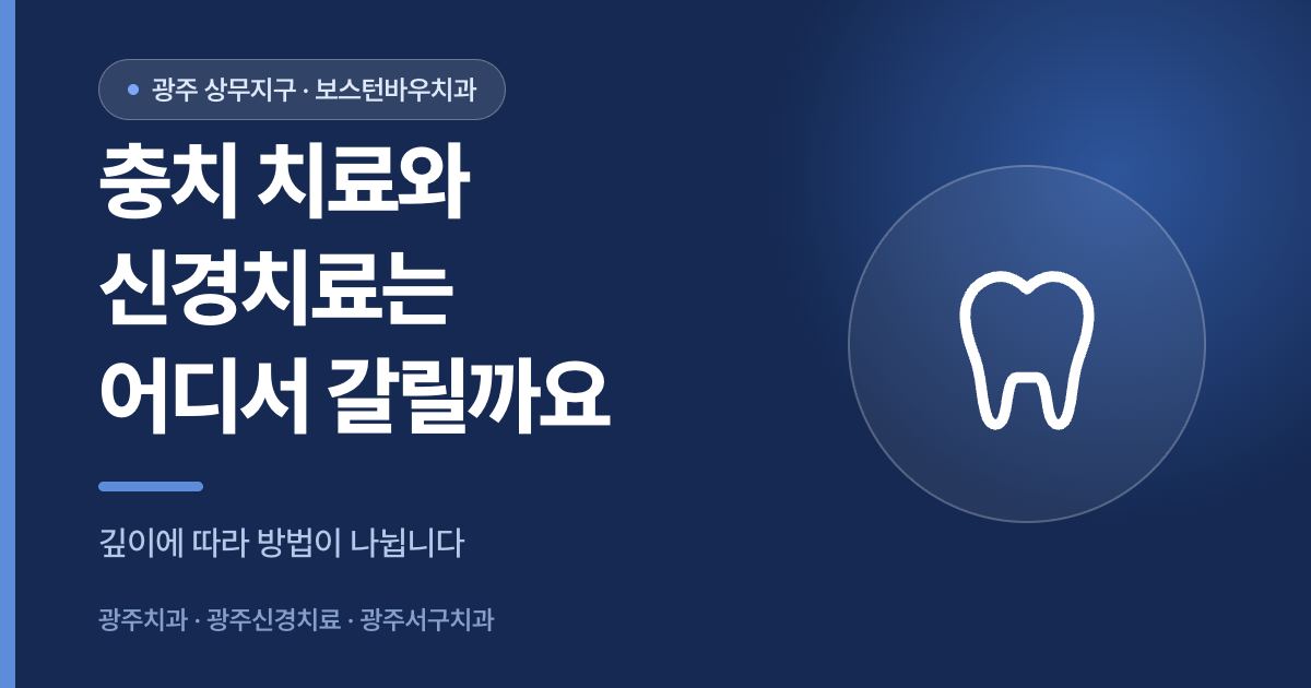 충치 치료와 광주신경치료가 나뉘는 기준을 설명하는 광주서구치과 썸네일