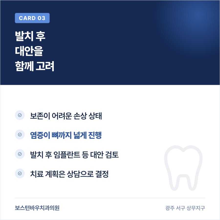 발치 후 대안 카드뉴스