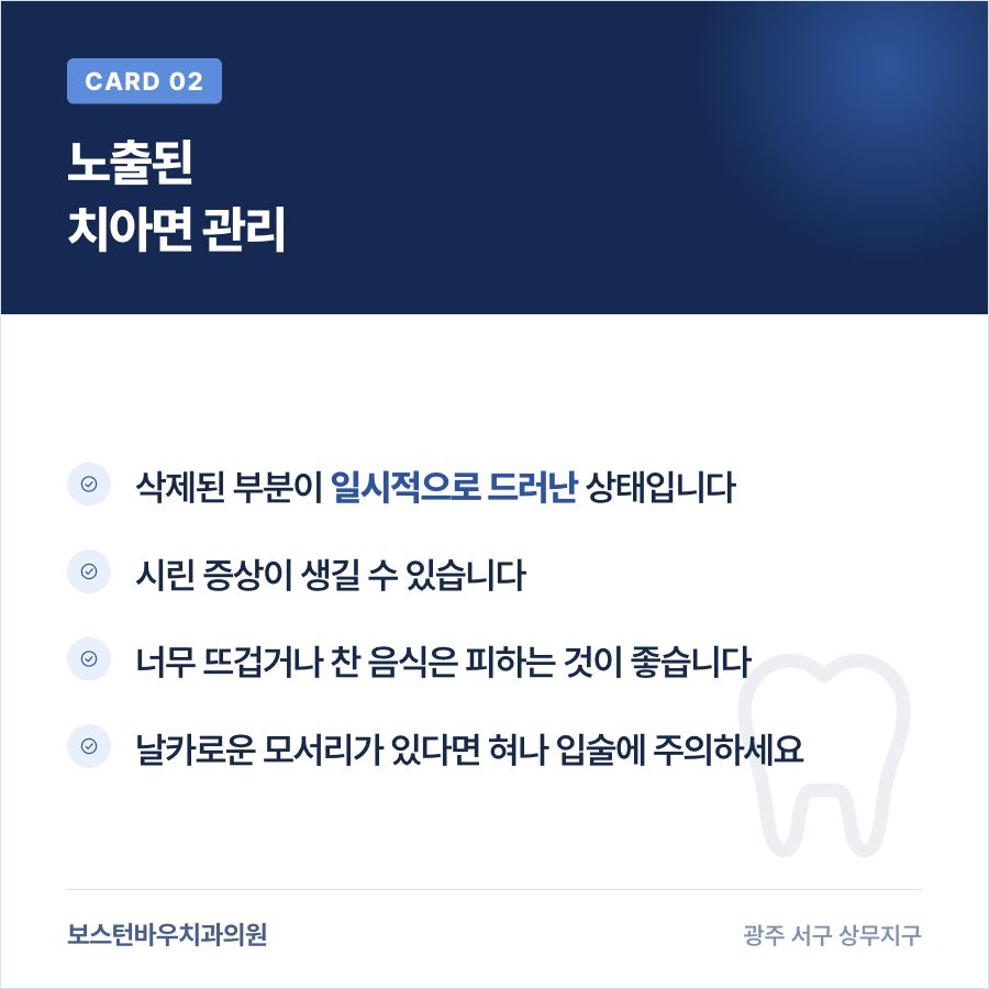 상무지구치과 라미네이트 탈락 후 치아면 관리 안내 이미지