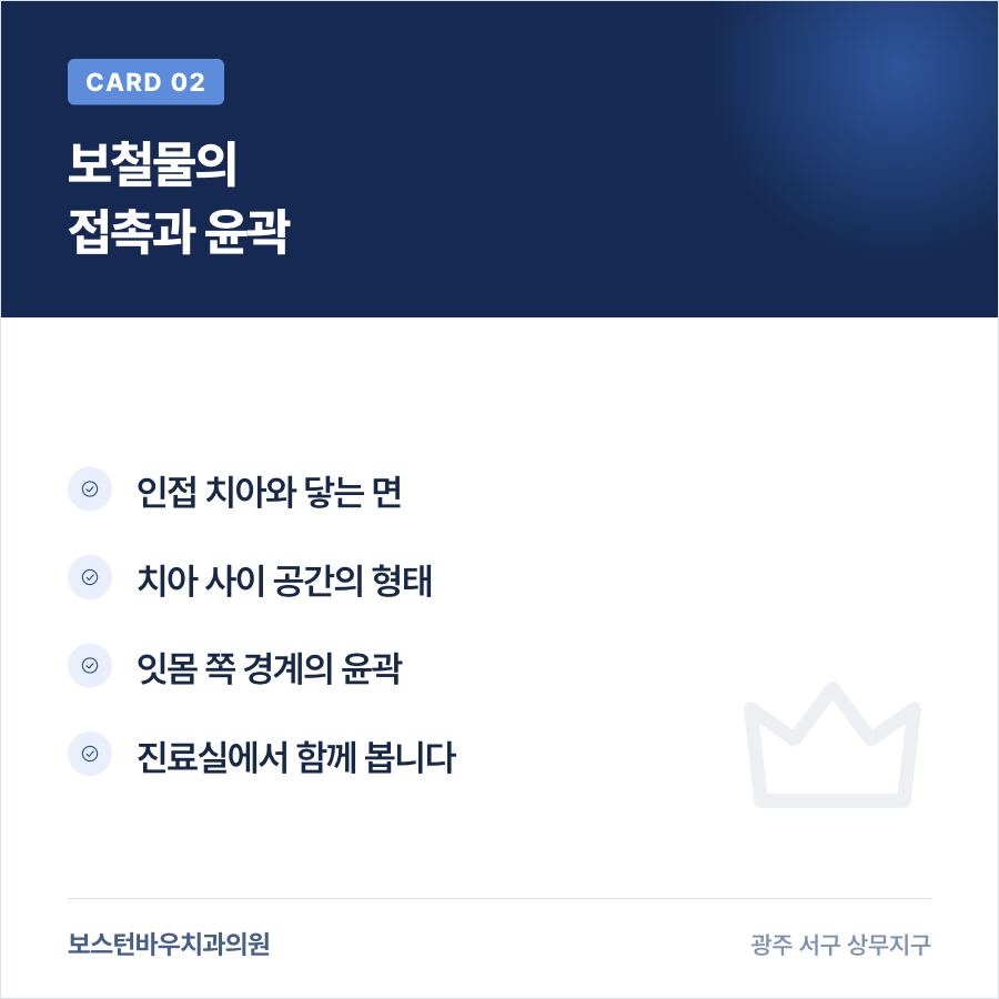 상무지구치과 임플란트 보철 접촉점 점검 카드
