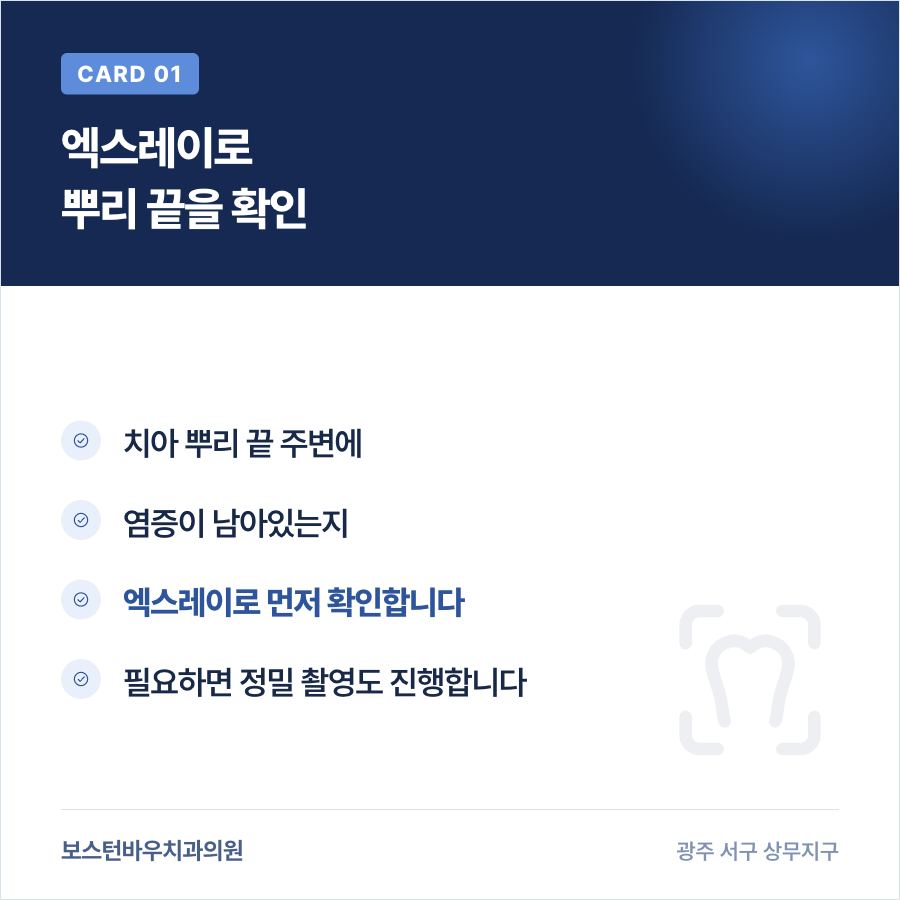 재신경치료 전 엑스레이 뿌리 확인 카드뉴스, 광주재신경치료