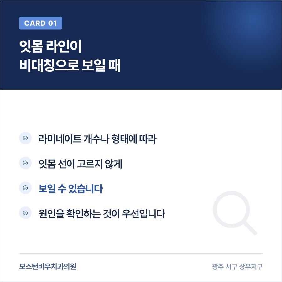라미네이트 잇몸 라인 비대칭 확인 카드뉴스, 앞니라미네이트