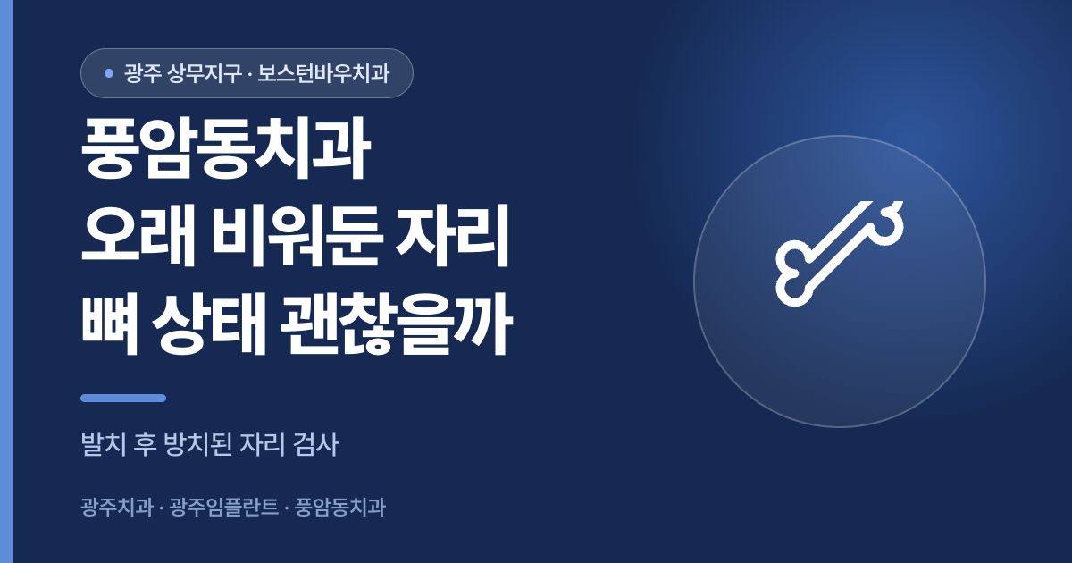 풍암동치과 임플란트 전 오래 비워둔 자리 뼈 상태를 안내하는 썸네일