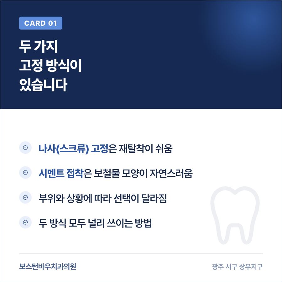 쌍촌동치과 임플란트 보철물 고정 방식 비교 카드뉴스
