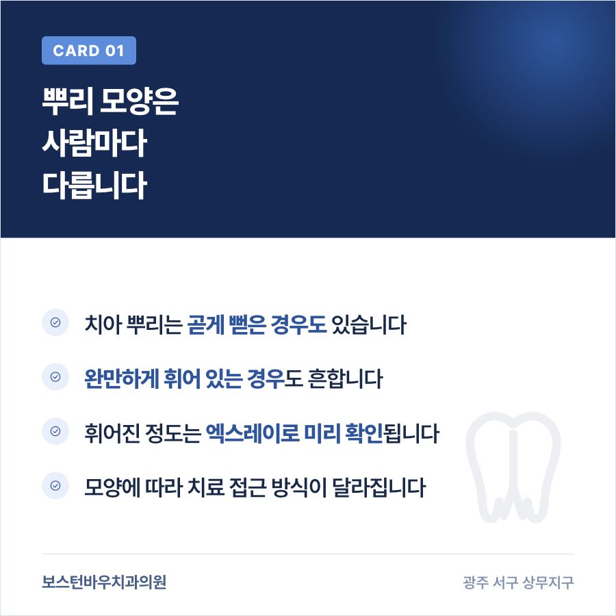 치아 뿌리 모양에 따른 신경치료 접근 차이 이미지
