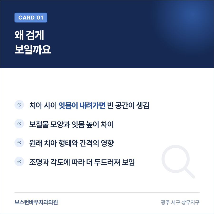 상무지구치과 라미네이트 후 치아 사이가 검게 보이는 이유 카드뉴스