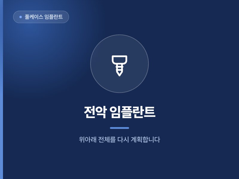 풀케이스 임플란트 전악 임플란트 위아래 전체를 다시 계획합니다