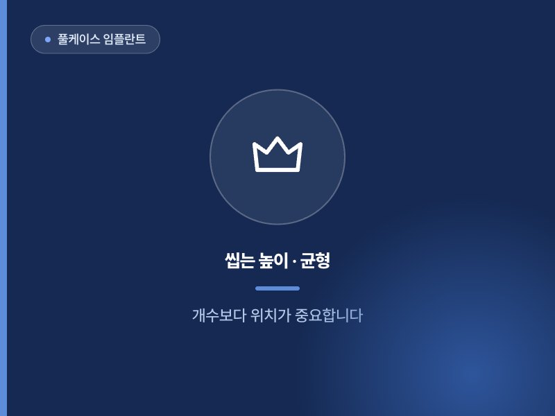 풀케이스 임플란트 씹는 높이 · 균형 개수보다 위치가 중요합니다