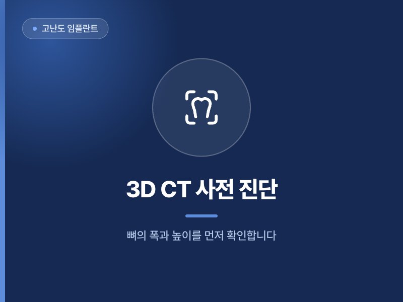 고난도 임플란트 3D CT 사전 진단 뼈의 폭과 높이를 먼저 확인합니다