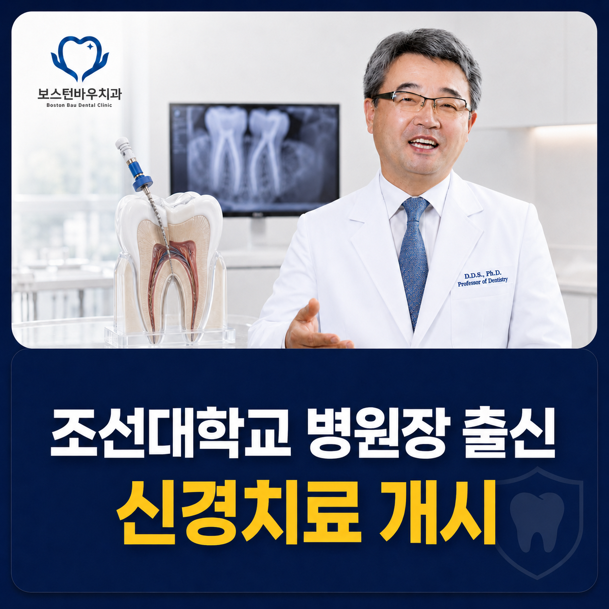 광주 신경치료 재신경치료